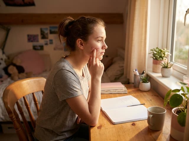 PCOS and Acne in Teens: When Breakouts Signal Something Bigger