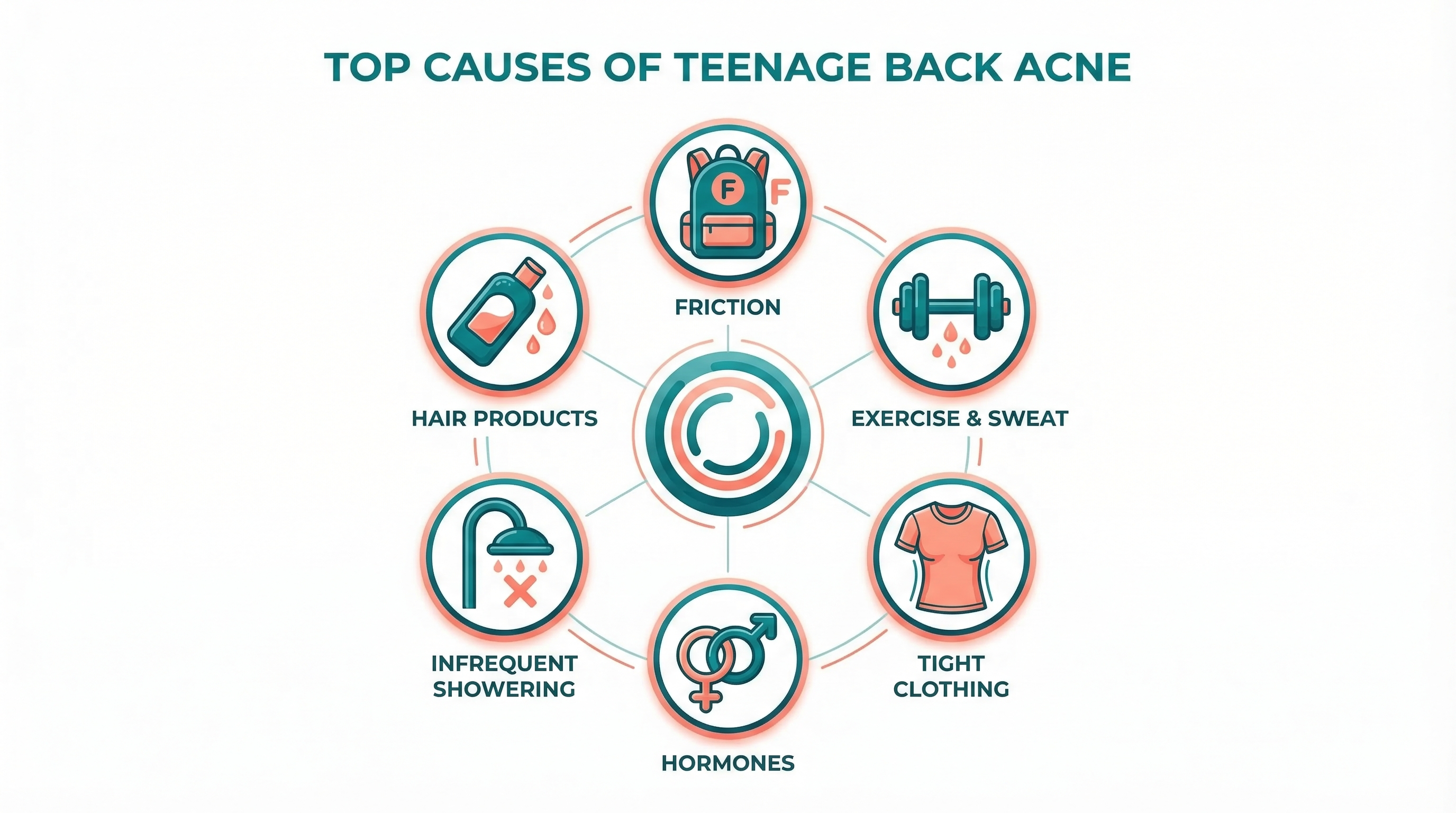 Diagram showing the difference between facial and back skin structure, highlighting thicker skin and larger oil glands on the back